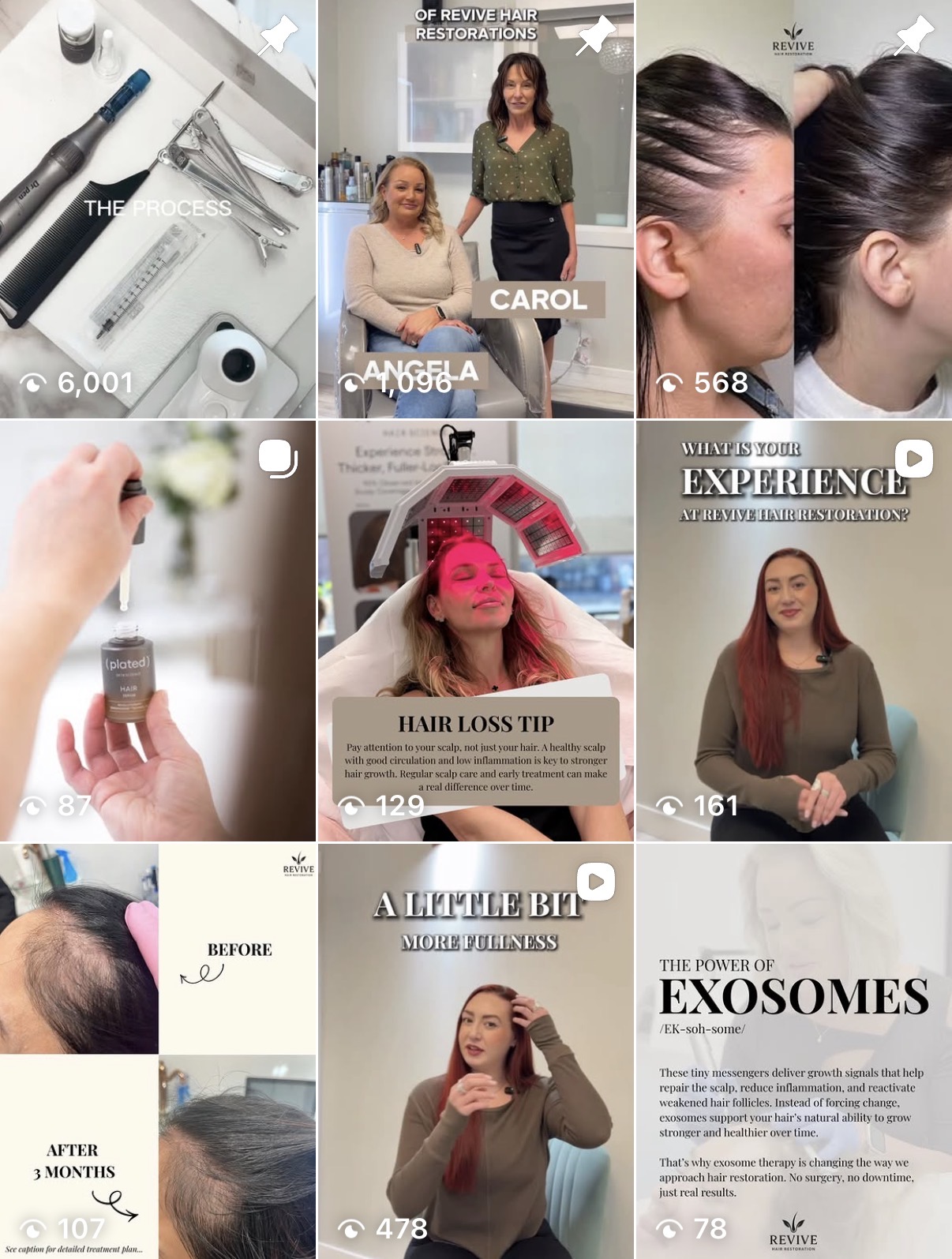 Revive Hair Restoration Instagram feed